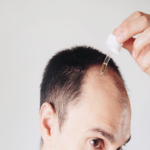 Hair growth, 7 factors that influence the speed of your hair growth